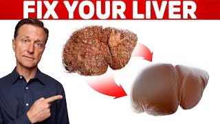 The 6 Best Ways to Heal a Fatty Liver [upl. by Roskes]