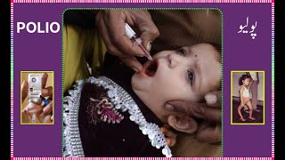 Polio  पोलियो  پولیو [upl. by Sheilah240]