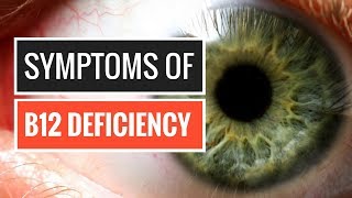 5 Signs and Symptoms of Vitamin B12 Deficiency [upl. by Aitnas756]