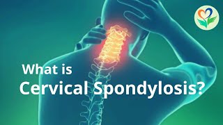 Cervical Spondylosis causes symptoms and treatment  Noble heart hospital [upl. by Tarton]