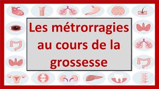 🔴HÉMORRAGIES GÉNITALES AU COURS DE LA GROSSESSE  hematome retroplacentaire  placenta previa [upl. by Edahc]