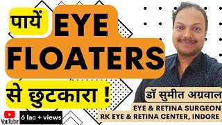 What are Eye Floaters  आई फ्लोटर्स से पाएं छुटकारा [upl. by Immij]