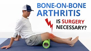 Bone on Bone Osteoarthritis Knee Pain Exercises amp Treatment Options [upl. by Aikemit]