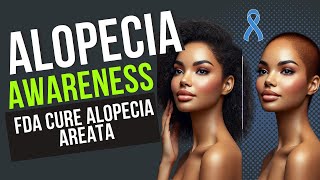 The FDA APPROVED Solution to Alopecia Areata Treatment [upl. by Zemaj573]