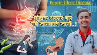 Peptic ulcerके हो त पेप्टिक अल्सरसबै जानकारी जानौं SignampSymptomsInvestigationTreatment in nepali [upl. by Mag101]