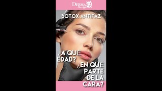 ¿En qué partes de la cara se aplica el BOTOX 💉 ANTIFAZ [upl. by Kassity]