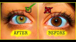 HOW TO CHANGE YOUR EYE COLOR  HOW TO GET GREEN EYES  100 WORKS [upl. by Aidaas]