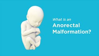 What Are Anorectal Malformations [upl. by Ange]