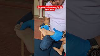 Chiropractic treatment for CP child drrajneeshkant worldfamouschiropractor [upl. by Yeaton]