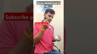 serum albumin test blood Test albuminalbumin bloodtest aj ki rattaiims initialscreening jart [upl. by Stormi744]