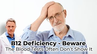 B12 Deficiency  Beware  the blood tests often don’t show it [upl. by Island875]