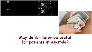 May defibrillator be useful for patients in asystole [upl. by Terr]