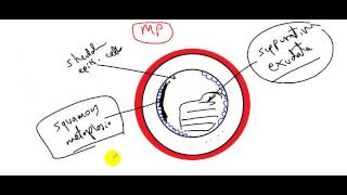 systemic pathology respiratory system bronchiectasis DR SAMEH GHAZY [upl. by Anairda364]