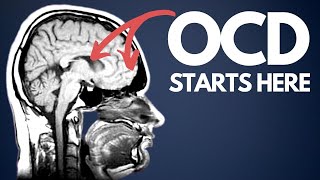 OCD explained for beginners  how I wish I was taught [upl. by Eneloj]