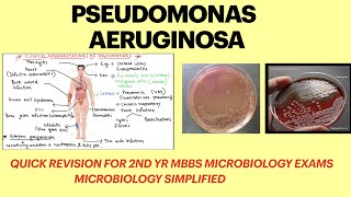 Pseudomonas aeruginosa  Pseudomonas infection  pseudomonas lab diagnosis  microbiology  MBBS [upl. by Nwahsek]