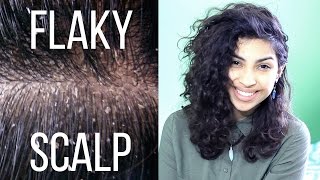 Causes  Fixes to a Flaky Scalp [upl. by Taro]