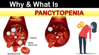 Why amp What Is Pancytopenia [upl. by Areik]