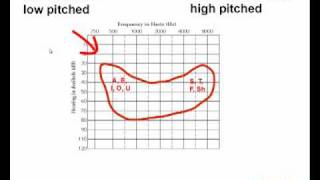 How to Read an Audiogram  Watch this Video Before You Buy Hearing Aids [upl. by Adliwa]