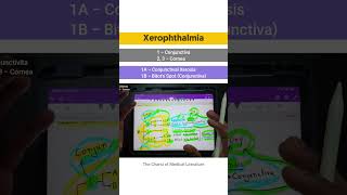 Xerophthalmia  Vitamin A deficiency tcml shorts shortsyoutube [upl. by Mixie287]