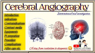 Cerebral Angiography Carotid Angiography Brain Angiography Interventional radiology BRT amp DRT [upl. by Sophey]