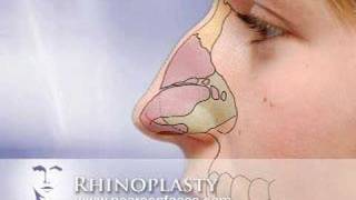 Rhinoplasty Nose Job at wwwPearsonFacescom [upl. by Mathia]