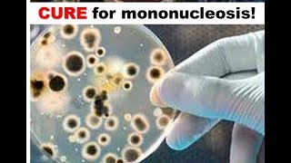 Cure for Mononucleosis [upl. by Eanar467]