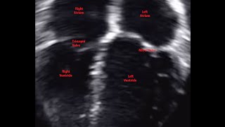 Four Chamber View  Apical Anatomical Orientation  Slow Motion [upl. by Leuamme192]