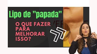 Fibrose na lipo de papada como melhorar [upl. by Hilbert]