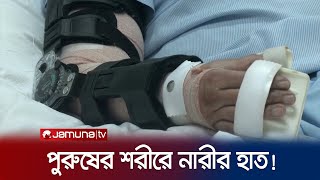 পুরুষের শরীরে লাগানো হল নারীর হাত ভারতে তোলপাড়  India Hand Transplant  Jamuna TV [upl. by Anahir]