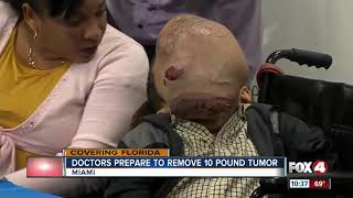 Doctors in Florida to Remove 10pound Tumor from Boys face [upl. by Waverly336]