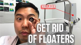 How to get rid of floaters in 2 MINUTES BUT IS IT SAFE  Ophthalmologist MichaelRChuaMD [upl. by Eterg]