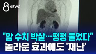 quot암 수치 박살…펑펑 울었다quot 놀라운 신약 효과에도 재난  SBS 8뉴스 [upl. by Caril]