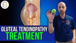 Gluteal Tendinopathy Treatment [upl. by Michiko]