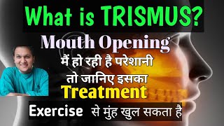 Trismus Treatment Causes and Symptoms  Problem in mouth opening [upl. by Thilde]