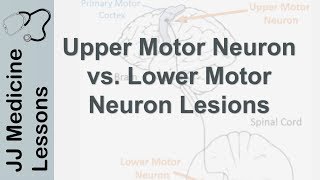 Upper and Lower Motor Neuron Lesions  UMN vs LMN Differences and Mnemonic [upl. by Silverts]