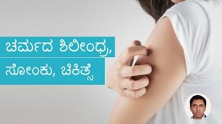 Fungal SkinInfections – Causes Symptoms And Treatment  Kannada [upl. by Vivica104]