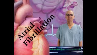 ATRIAL FIBRILLATION Diagnosis and Treatment [upl. by Ramilahs570]