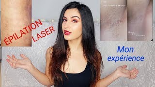 ÉPILATION DÉFINITIVE LASER  AISSELLESMAILLOTJAMBES JE VOUS MONTRE TOUS Expériences résultats [upl. by Alvina]