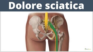 CURA la SCIATICA con questo SEMPLICE ESERCIZIO [upl. by Agem379]