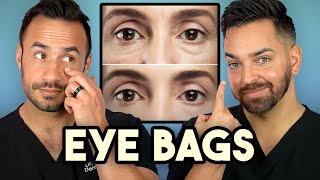 How Treat Under Eye Bags Like A Dermatologist [upl. by Aibonez]