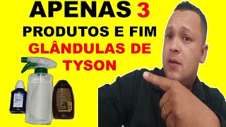 INCRÍVEL 3 Produtos e Remova Suas Glândulas de Tyson as Bolinhas Brancas em 7 DIAS [upl. by Iral]