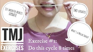 Vlog 6  1st month braces update  Molar Band  TMJ exercises  TMD treatment updates [upl. by Victorie609]