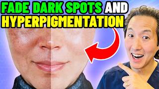 Plastic Surgeon Reveals 5 Ways to Get Rid of Hyperpigmentation Melasma and Spots [upl. by Azitram467]