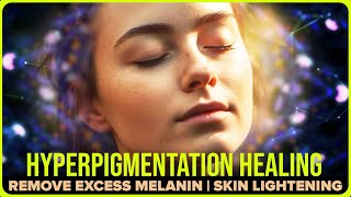 Binaural Beats for AntiAging and Skin Lightening Hyperpigmentation Healing Frequency Subliminal [upl. by Atis607]