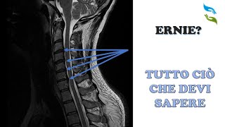 Risonanza magnetica cervicale ERNIE e PATOLOGIE [upl. by Anaerdna]