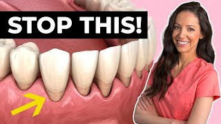 6 Ways Youre Causing Gum Recession Right Now [upl. by Quick]