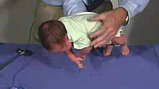 physical exam Newborn Normal PositionsVentral Suspension [upl. by Alyek]