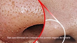 Tips que Eliminan en 3 minutos los puntos negros de tu nariz [upl. by Eugenia]