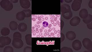 Differential leukocyte count WBC dlc microscopy viralvideos hematology [upl. by Suiddaht]