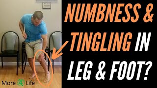 Numbness and Tingling In Leg and Foot [upl. by Aiblis]